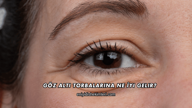 Göz Altı Torbalarına Ne İyi Gelir?