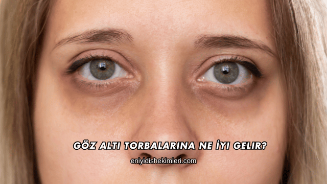 Göz Altı Torbalarına Ne İyi Gelir?