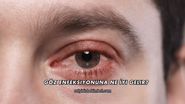 Göz Enfeksiyonuna Ne İyi Gelir?