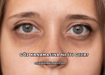 Göz Kanamasına Ne İyi Gelir?