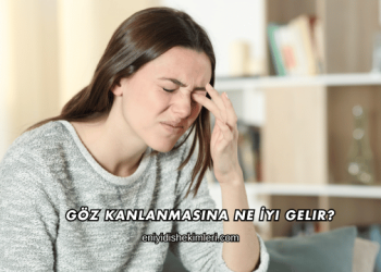 Göz Kanlanmasına Ne İyi Gelir?