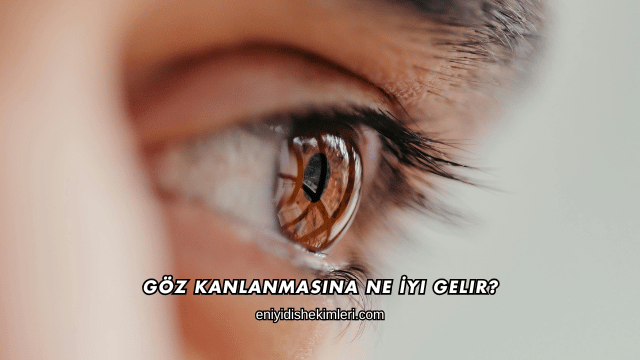 Göz Kanlanmasına Ne İyi Gelir?