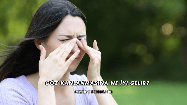 Göz Kanlanmasına Ne İyi Gelir?
