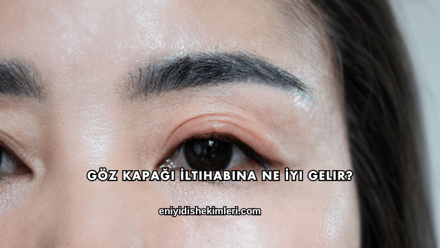 Göz Kapağı İltihabına Ne İyi Gelir?