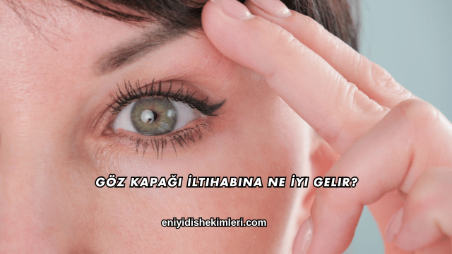 Göz Kapağı İltihabına Ne İyi Gelir?