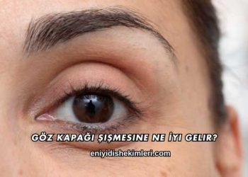 Göz Kapağı Şişmesine Ne İyi Gelir?