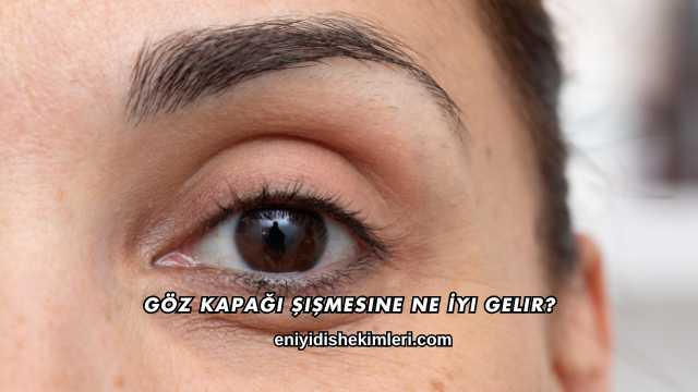 Göz Kapağı Şişmesine Ne İyi Gelir?