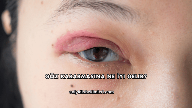 Göz Kararmasına Ne İyi Gelir?