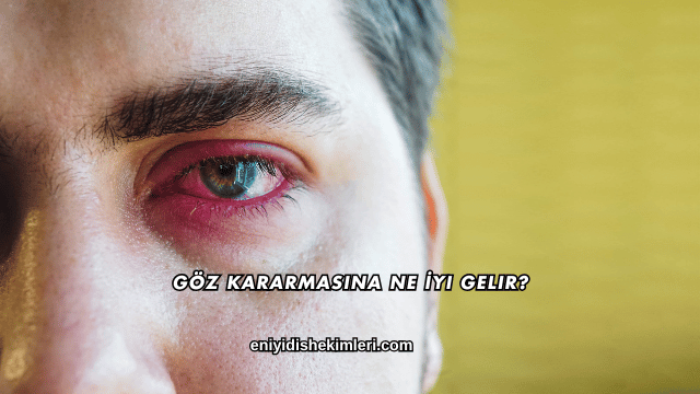 Göz Kararmasına Ne İyi Gelir?