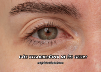 Göz Kızarıklığına Ne İyi Gelir?