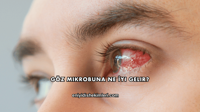 Göz Mikrobuna Ne İyi Gelir?