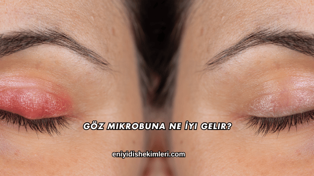 Göz Mikrobuna Ne İyi Gelir?
