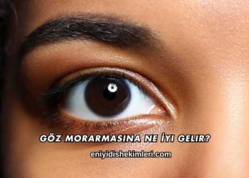 Göz Morarmasına Ne İyi Gelir?