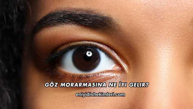 Göz Morarmasına Ne İyi Gelir?