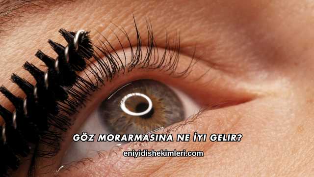 Göz Morarmasına Ne İyi Gelir?