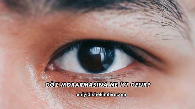 Göz Morarmasına Ne İyi Gelir?