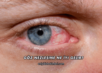 Göz Nezlesine Ne İyi Gelir?