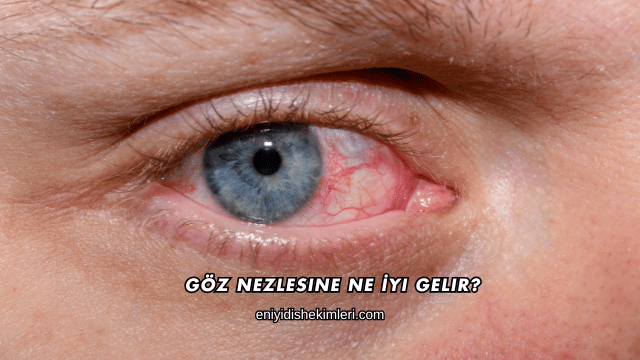 Göz Nezlesine Ne İyi Gelir?
