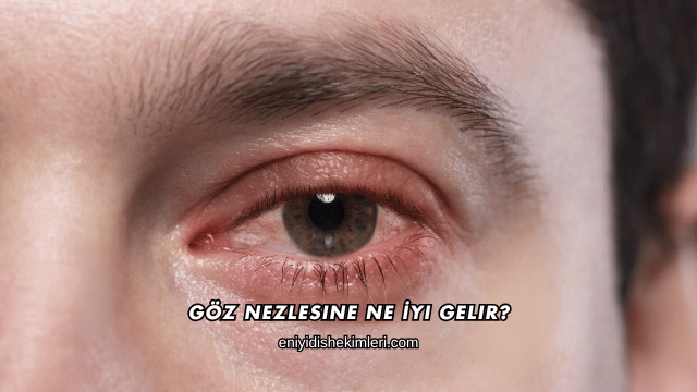 Göz Nezlesine Ne İyi Gelir?
