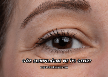 Göz Şişkinliğine Ne İyi Gelir?
