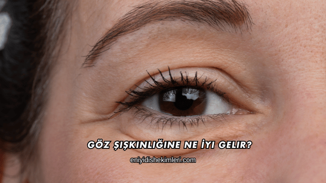 Göz Şişkinliğine Ne İyi Gelir?