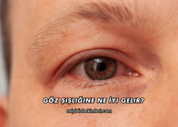 Göz Şişliğine Ne İyi Gelir?