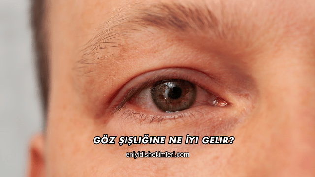 Göz Şişliğine Ne İyi Gelir?