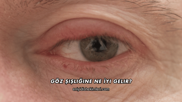 Göz Şişliğine Ne İyi Gelir?