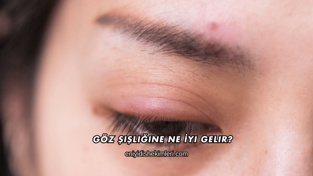 Göz Şişliğine Ne İyi Gelir?