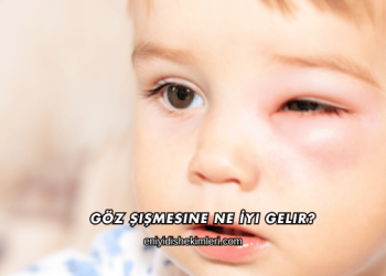 Göz Şişmesine Ne İyi Gelir?