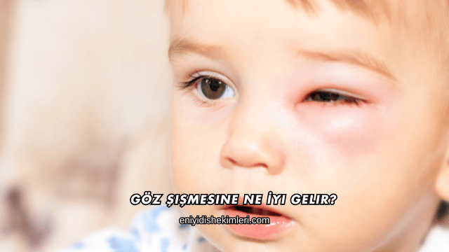Göz Şişmesine Ne İyi Gelir?