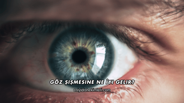 Göz Şişmesine Ne İyi Gelir?