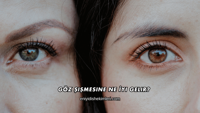 Göz Şişmesine Ne İyi Gelir?