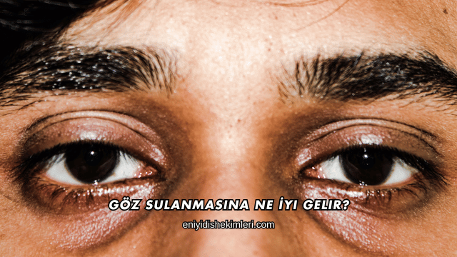 Göz Sulanmasına Ne İyi Gelir?