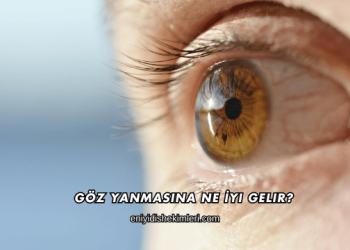 Göz Yanmasına Ne İyi Gelir?