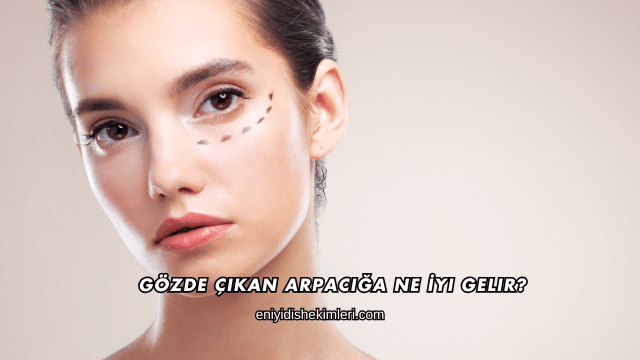 Gözde Çıkan Arpacığa Ne İyi Gelir?