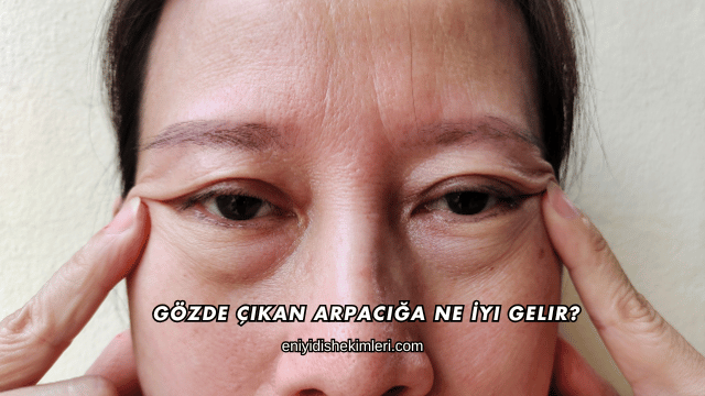 Gözde Çıkan Arpacığa Ne İyi Gelir?