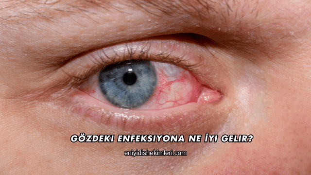 Gözdeki Enfeksiyona Ne İyi Gelir?