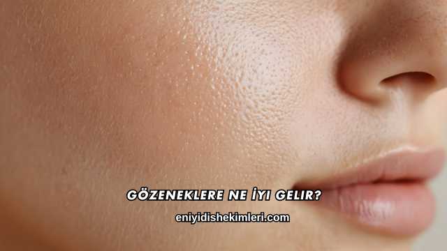 Gözeneklere Ne İyi Gelir?