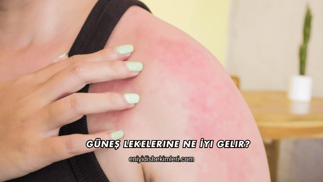 Güneş Lekelerine Ne İyi Gelir?