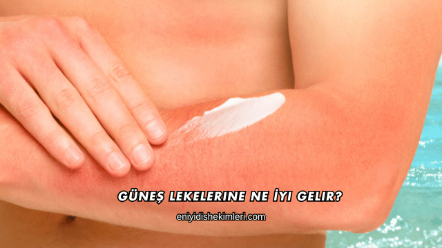 Güneş Lekelerine Ne İyi Gelir?