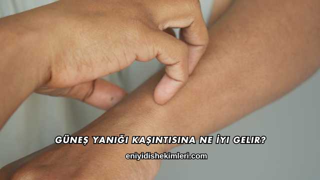 Güneş Yanığı Kaşıntısına Ne İyi Gelir?