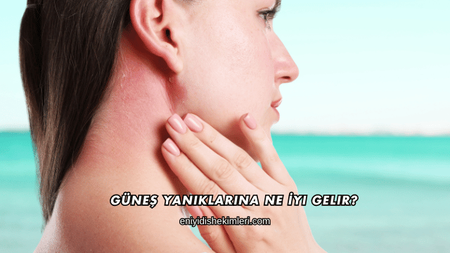 Güneş Yanıklarına Ne İyi Gelir?