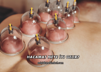 Hacamat Neye İyi Gelir?