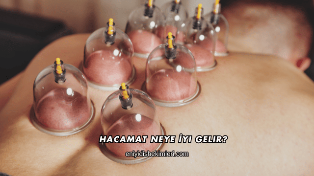Hacamat Neye İyi Gelir?