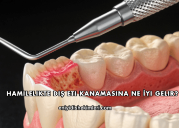 Hamilelikte Diş Eti Kanamasına Ne İyi Gelir?
