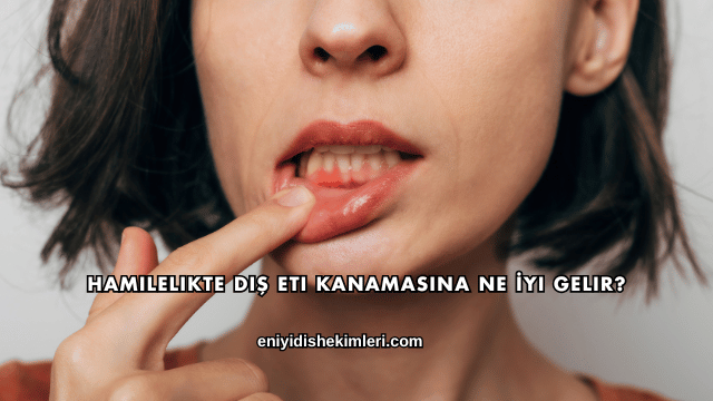 Hamilelikte Diş Eti Kanamasına Ne İyi Gelir?