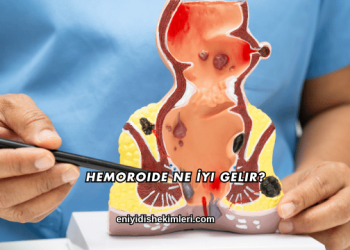 Hemoroide Ne İyi Gelir?