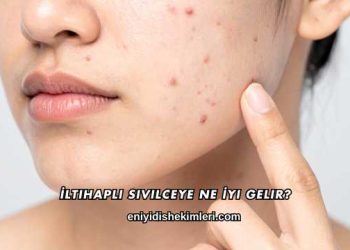 İltihaplı Sivilceye Ne İyi Gelir?