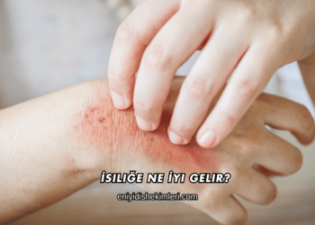 İsiliğe Ne İyi Gelir?